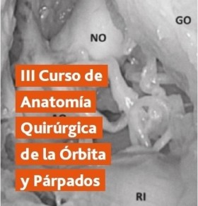 III Curso de Anatomía Quirúrgica de la Órbita y Párpados. 7 Octubre 2017 - ORL Sant Pau-Barcelona